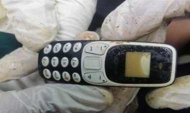 استخراج هاتف محمول من بطن شاب بعد عامين على ابتلاعه