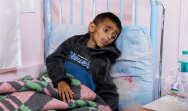 الأمم المتحدة تعلن وفاة أكثر من 100 طفل في غزة بسبب "التجويع"